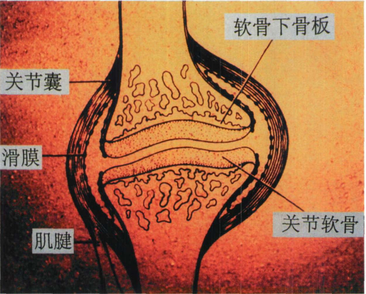 1.關(guān)節(jié)模式圖